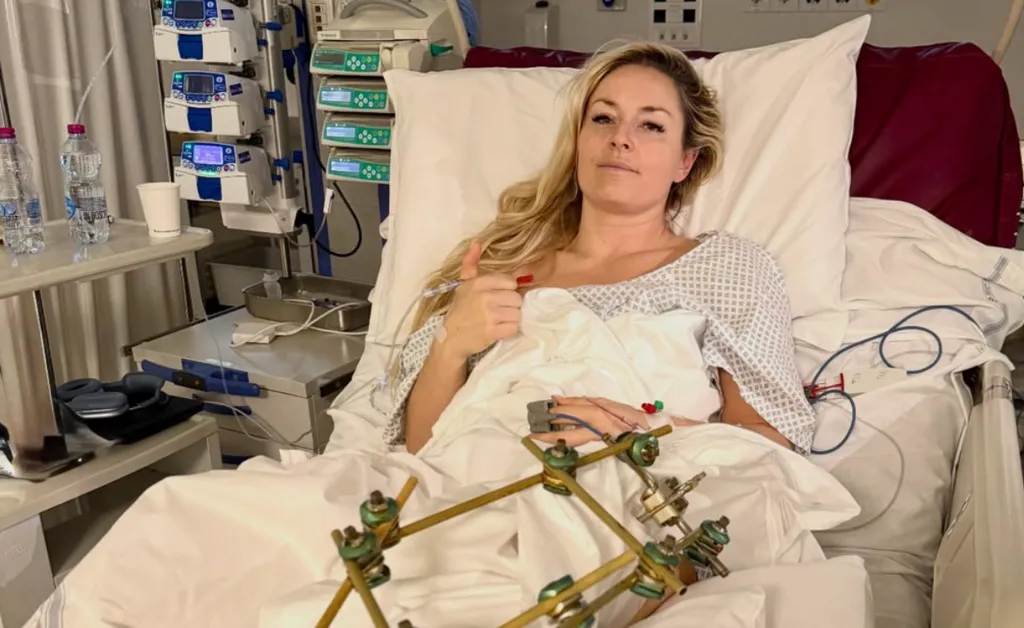 Vonn Recovers from Third Leg Surgery