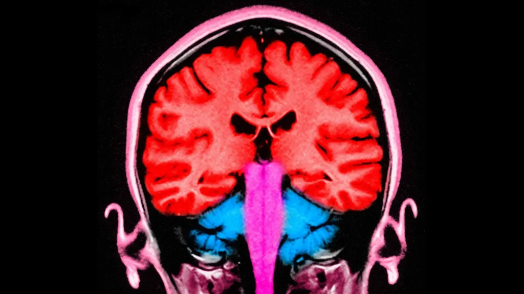 Study Explores if Brain Stimulation Can Reduce Selfish Behavior